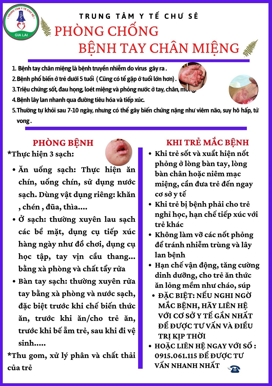 phong chong Tay chan mieng